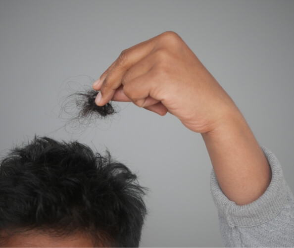 hair loss